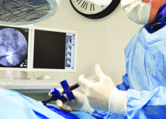 How stem cells can help with fibromyalgia
